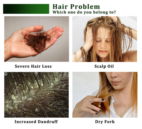 Hair Growth Essential Oil - ROUTINE FASHION