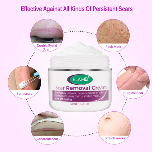 Skin Rebound Scarless Cream Scar Removal Cream Face Cream For Face Acne Scar Stretch Marks Skin Repair Face Cream - ROUTINE FASHION