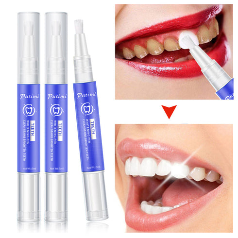 Teeth whitening pen - ROUTINE FASHION
