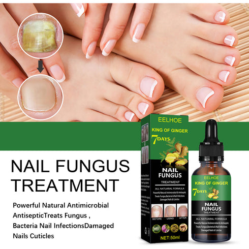 Nail Repair Solution Hand Foot And Nail Care Solution - ROUTINE FASHION
