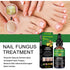 Nail Repair Solution Hand Foot And Nail Care Solution - ROUTINE FASHION