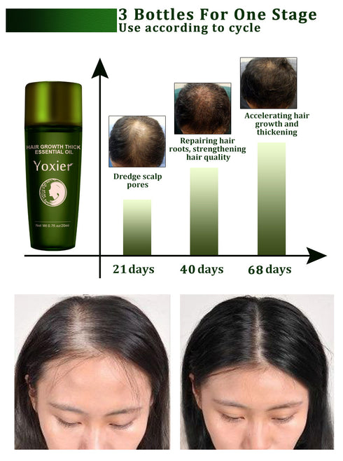 Hair Growth Essential Oil - ROUTINE FASHION