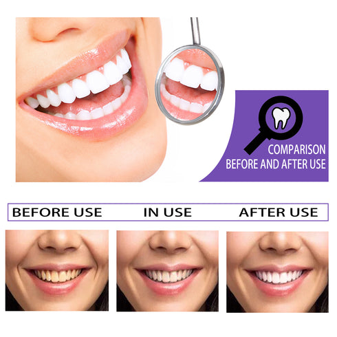 Teeth Whitening Toothpaste Whitening Teeth Removal - ROUTINE FASHION