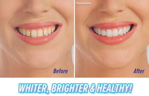 Dental Scaler Polishing Vibrating Dental Instrument - ROUTINE FASHION