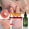 Remove Face Oil Acne Gentle Moisturizing Acne Pit Repair Liquid Fade Face Acne Marks Essential Oil - ROUTINE FASHION