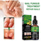 Nail Repair Solution Hand Foot And Nail Care Solution - ROUTINE FASHION