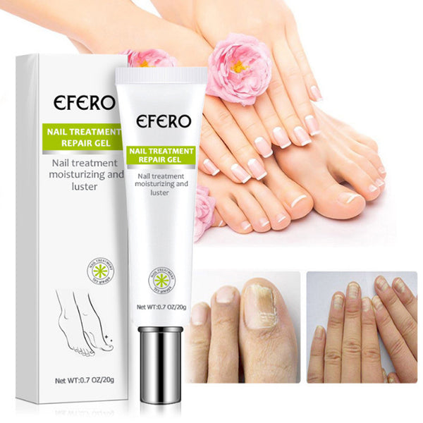 Nail Treatment Serum Nail Foot Nail Fungus Removal Gel Anti Infection Onychomycosis Nail Repair Essence Cream Feet Care - ROUTINE FASHION