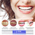 Teeth whitening pen - ROUTINE FASHION