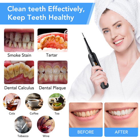 Portable Electric Tooth Cleaner, Dental Care Tool, Tooth Cleaner - ROUTINE FASHION
