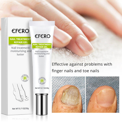 Nail Treatment Serum Nail Foot Nail Fungus Removal Gel Anti Infection Onychomycosis Nail Repair Essence Cream Feet Care - ROUTINE FASHION