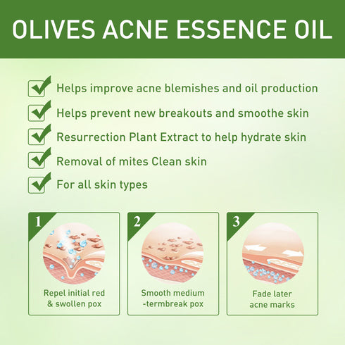 Remove Face Oil Acne Gentle Moisturizing Acne Pit Repair Liquid Fade Face Acne Marks Essential Oil - ROUTINE FASHION
